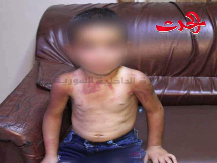 شرطة المزة الشرقية تلقي القبض على أم تعذب طفلها اشد انواع التعذيب