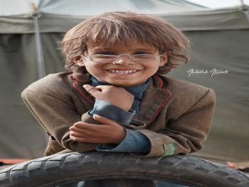 ما هو جديد نظارة الطفل اليمني التي شغلت مواقع التواصل الاجتماعي