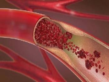 كيف تستطيع تخفيض الكوليسترول في الدم بدون ادوية 