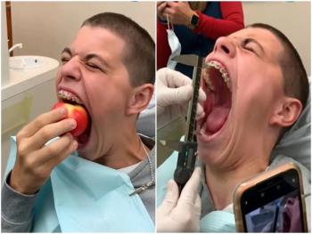 شاب أمريكي يدخل موسوعة غينيس بأكبر فم في العالم 
