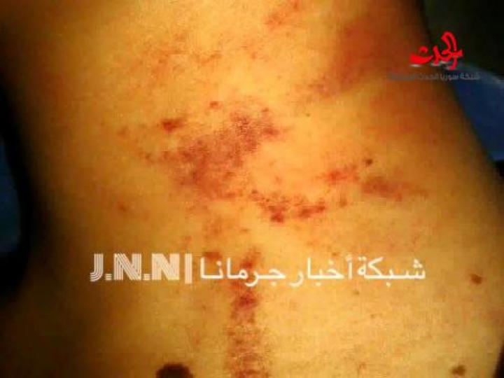 ضرب مبرح لطالب في مدرسة الشهيد ادهم عزالدين في جرمانا بريف دمشق