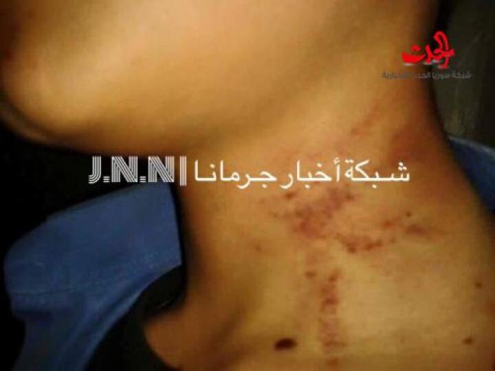 ضرب مبرح لطالب في مدرسة الشهيد ادهم عزالدين في جرمانا بريف دمشق