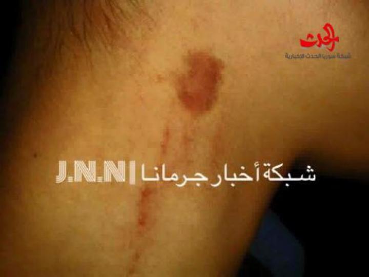 ضرب مبرح لطالب في مدرسة الشهيد ادهم عزالدين في جرمانا بريف دمشق