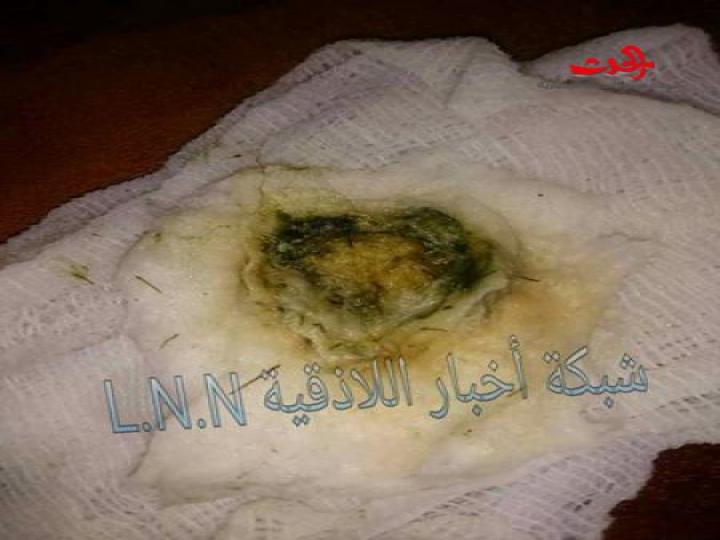 السيد رئيس مجلس الوزراء : حشرات وديدان في مياه الشرب باللاذقية 