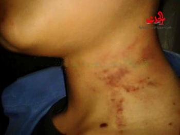 ضرب مبرح لطالب في مدرسة الشهيد ادهم عزالدين في جرمانا بريف دمشق