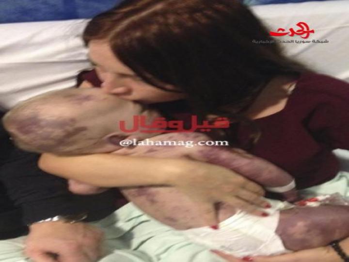 صور صادمة ومؤلمة .. أم تعرض اللحظات الأخيرة من حياة طفلها!