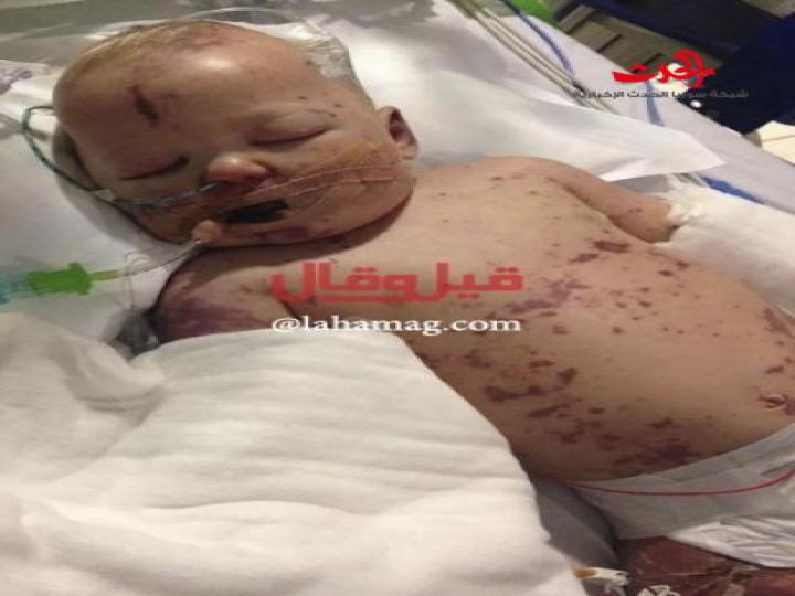 صور صادمة ومؤلمة .. أم تعرض اللحظات الأخيرة من حياة طفلها!