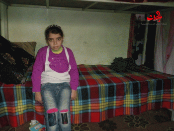 الطفلة دلع محمد المحمد من أطفال تفجيرات مدرسة عكرمة الذين مازالو يعانوا آثار المعاناة 