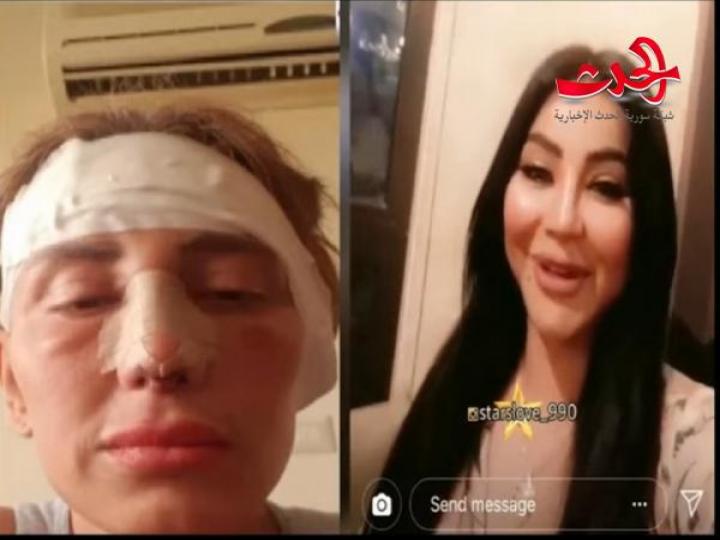 تشوه وجه لجين عمران بسبب الفيلر ! و ريهام سعيد تظهر للمرة الاولى بعد استئصال انفها 