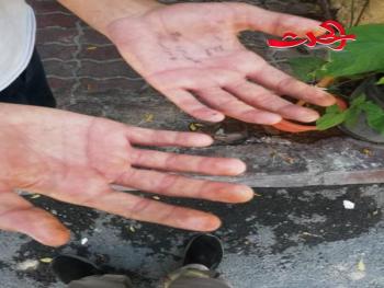 أستاذ فيزياء يضرب تلميذا 40 مسطرة لأنه استعار قلماً!