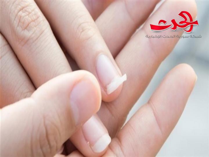 تقصف الأظافر قد ينذر بمشاكل صحية