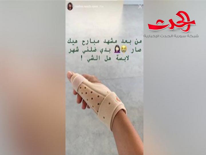 نادين نجيم تتعرض لكسر في يدها اثر مشاجرة في موقع التصوير