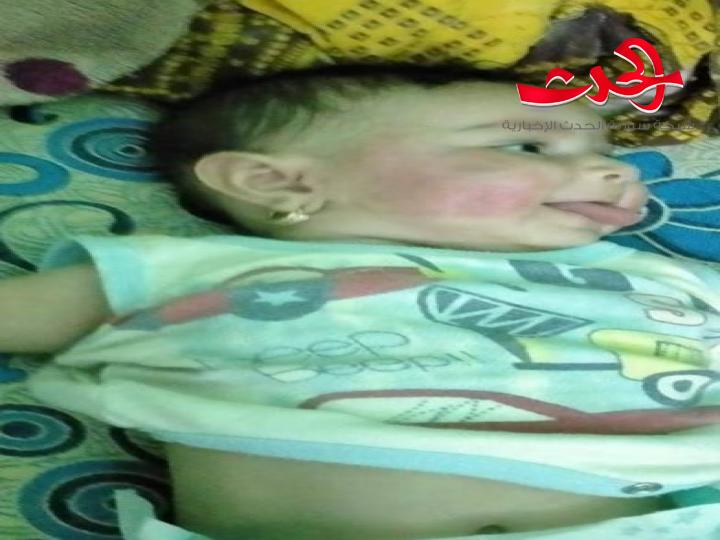 غضب واسع في مصر من فيديو لاب يهشم عظام طفلته الرضيعة