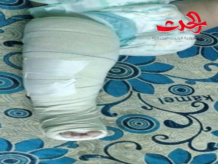 غضب واسع في مصر من فيديو لاب يهشم عظام طفلته الرضيعة