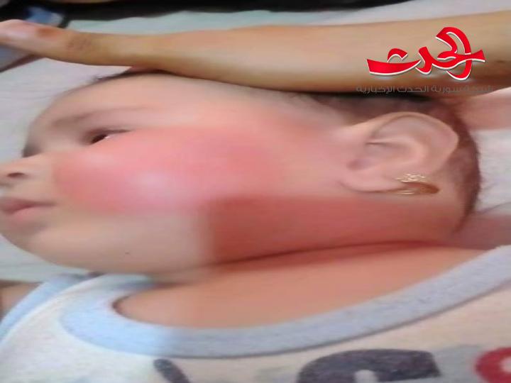 غضب واسع في مصر من فيديو لاب يهشم عظام طفلته الرضيعة