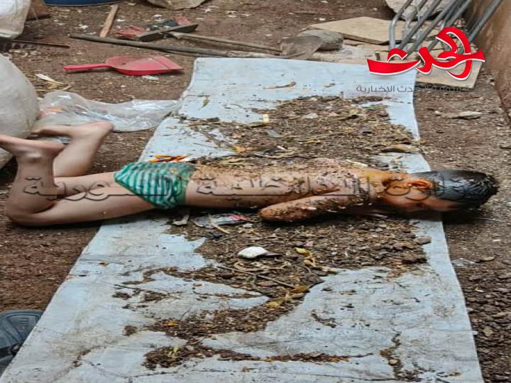 تعذيب طفل في حي الشماس ب حمص بطريقة وحشية