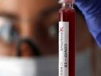 طبيبة سورية: نوع فصيلة الدم يلعب دورا في مقاومة أعراض كورونا
