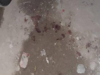 سقوط طفل من الطابق الثالث في جرمانا بريف دمشق