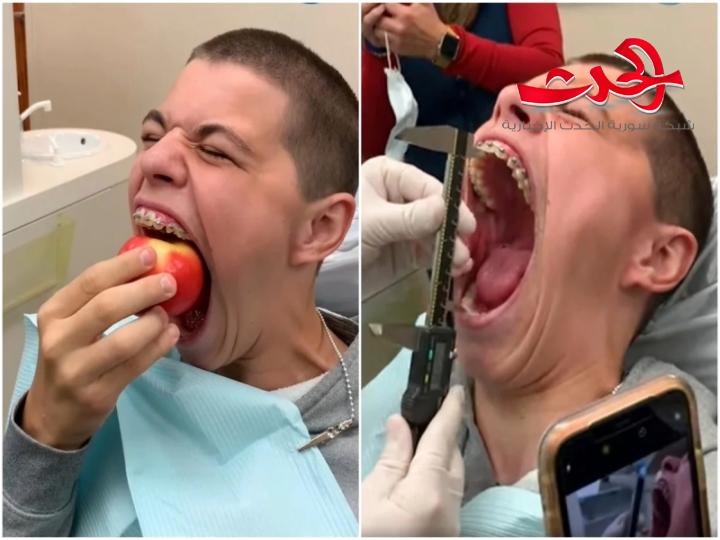 شاب أمريكي يدخل موسوعة غينيس بأكبر فم في العالم 